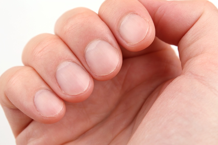 Psoriasis-Ltd III patients need to keep their fingernails trimmed and clean, to help from scratching, that could lead to an infection